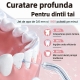 Irigator Bucal Electric,  Portabil, Dus Bucal pentru Curatare, Indepartare Tartru, 4 Capete, 25 x 8 x 8 cm, Negru